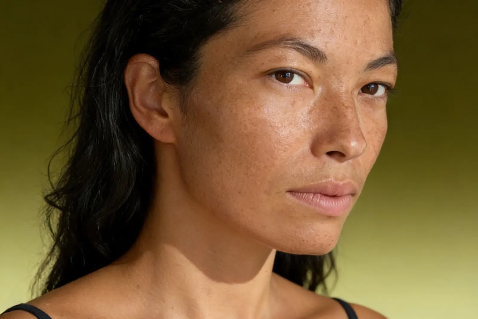 Лазерная шлифовка c MCL 31 Dermablate