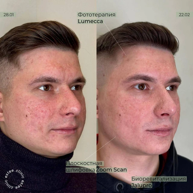 Комплексный подход